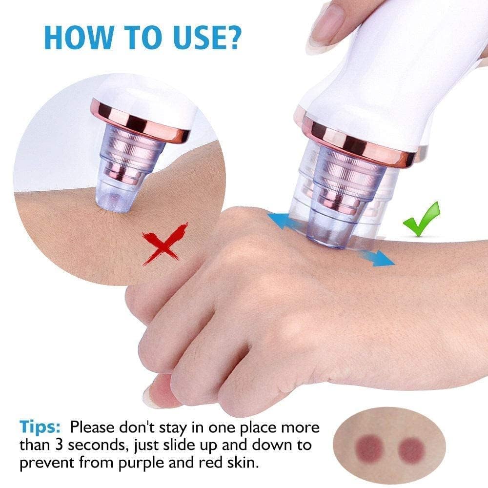 Electric Blackhead Remover Pore Cleaner