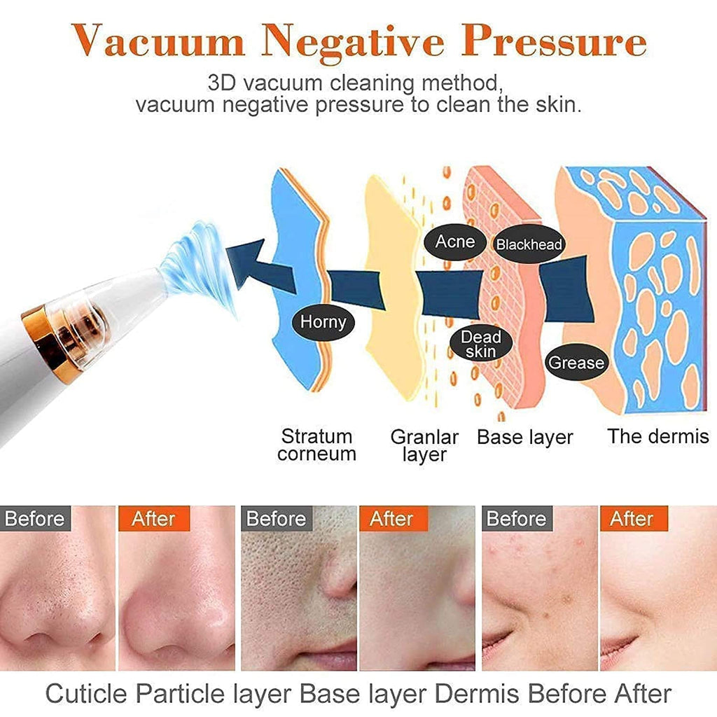 Electric Blackhead Remover Pore Cleaner
