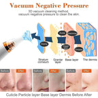Electric Blackhead Remover Pore Cleaner